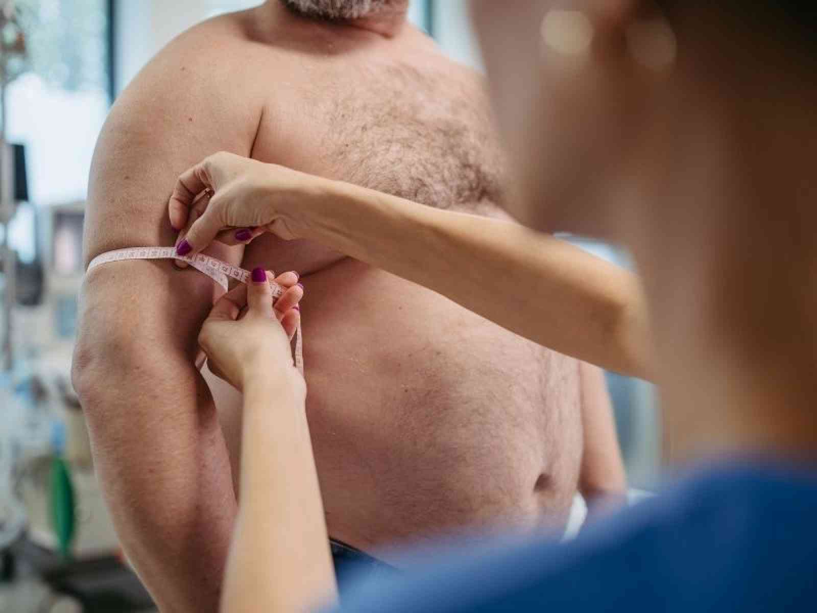 Schlauchmagen in der Adipositasbehandlung